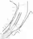 Fig. 01 - Method and apparatus for endovascular graft cutting