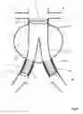 Fig. 02 - Method and apparatus for endovascular graft cutting