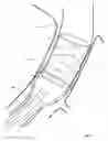 Fig. 09 - Method and apparatus for endovascular graft cutting