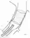 Fig. 16 - Method and apparatus for endovascular graft cutting