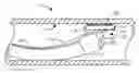 Fig. 01 - Auto-aligning ablating device and method of use