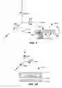 Fig. 02 - Auto-aligning ablating device and method of use