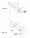 Fig. 07 - Radio frequency lasso