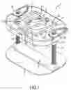 Fig. 02 - Percutaneous scaphoid fixation method and device