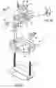 Fig. 03 - Percutaneous scaphoid fixation method and device