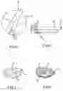 Fig. 06 - Percutaneous scaphoid fixation method and device