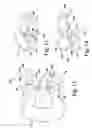 Fig. 06 - Spinous process anchoring systems and methods