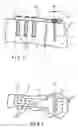 Fig. 02 - Fracture fixation system