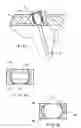 Fig. 06 - Fracture fixation system
