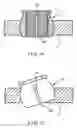 Fig. 08 - Fracture fixation system