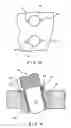 Fig. 09 - Fracture fixation system