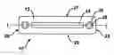 Fig. 01 - Implant fixation methods and apparatus