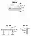 Fig. 06 - Implant fixation methods and apparatus