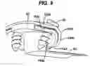 Fig. 09 - Implant fixation methods and apparatus