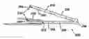 Fig. 01 - Implant fixation methods and apparatus