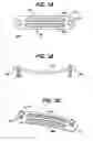 Fig. 03 - Implant fixation methods and apparatus