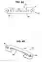 Fig. 04 - Implant fixation methods and apparatus