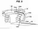 Fig. 09 - Implant fixation methods and apparatus
