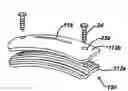Fig. 01 - Implant fixation methods and apparatus