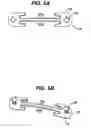 Fig. 05 - Implant fixation methods and apparatus