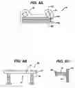 Fig. 06 - Implant fixation methods and apparatus
