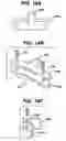 Fig. 14 - Implant fixation methods and apparatus