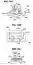 Fig. 16 - Implant fixation methods and apparatus
