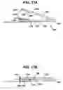 Fig. 17 - Implant fixation methods and apparatus