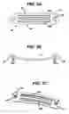 Fig. 03 - Implant fixation methods and apparatus