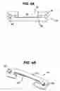 Fig. 04 - Implant fixation methods and apparatus
