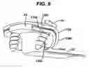 Fig. 09 - Implant fixation methods and apparatus