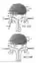 Fig. 25 - Intervertebral disc anulus repair