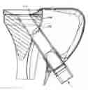 Fig. 01 - Tibial resurfacing system