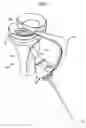 Fig. 03 - Tibial resurfacing system