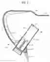 Fig. 04 - Tibial resurfacing system