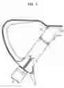 Fig. 06 - Tibial resurfacing system