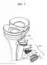 Fig. 08 - Tibial resurfacing system