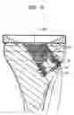 Fig. 11 - Tibial resurfacing system