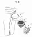 Fig. 13 - Tibial resurfacing system