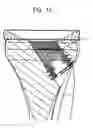 Fig. 14 - Tibial resurfacing system