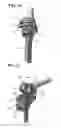 Fig. 08 - ALIGNMENT AND CONNECTION DEVICE OF FEMUR CUTTER AND TIBIA CUTTER AND METHOD OF KNEE ARTHROPLASTY USING THE SAME