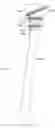 Fig. 07 - Method and apparatus for navigating a cutting tool during orthopedic surgery using a localization system