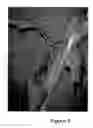 Fig. 08 - Method and apparatus for navigating a cutting tool during orthopedic surgery using a localization system