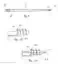 Fig. 07 - Systems and methods for reducing fractured bone using a fracture reduction cannula