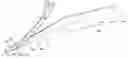 Fig. 01 - Cuffed-catheter removal device