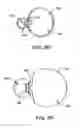 Fig. 08 - Obesity treatment tools and methods