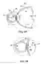 Fig. 10 - Obesity treatment tools and methods