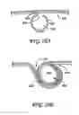 Fig. 23 - Obesity treatment tools and methods