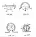 Fig. 24 - Obesity treatment tools and methods