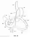 Fig. 35 - Obesity treatment tools and methods
